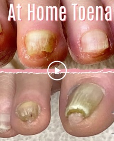 ??DIY Pedicure At Home - Simple Tips & Tricks for Daily Toenail Care??